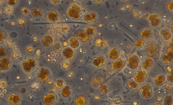 Panssarisiimalevä Karlodinium veneficumin kasvustoa mikroskoopissa.